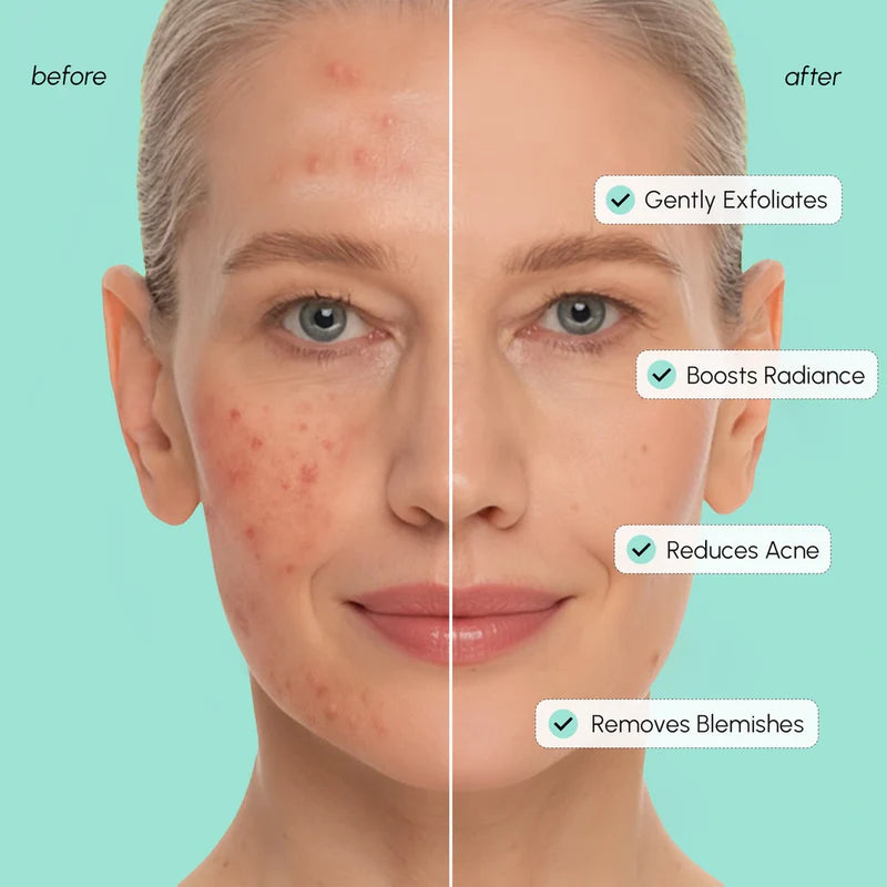 MARÉE Azelaic Acid Soothing Pads