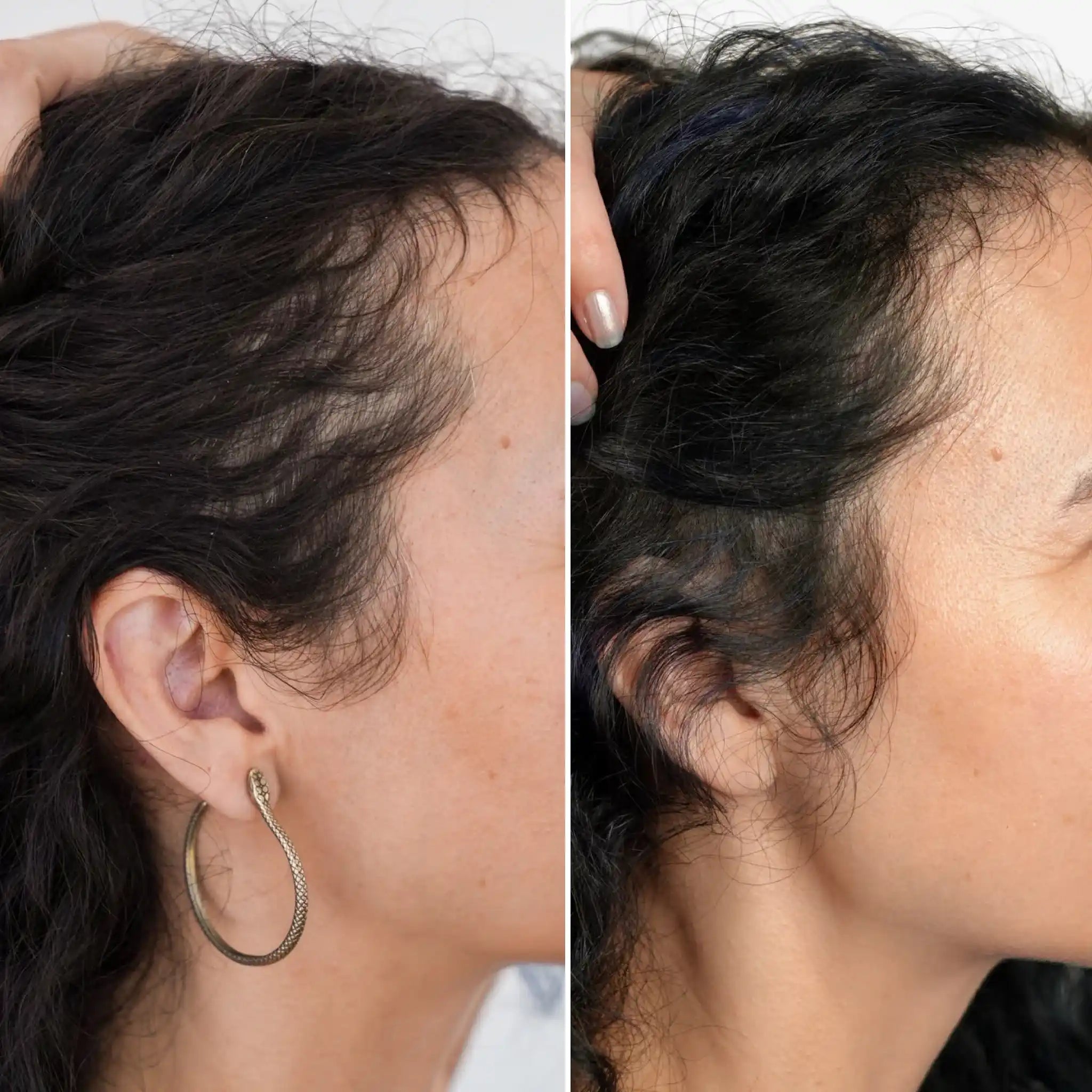 Hair Growth & Thickness Serum