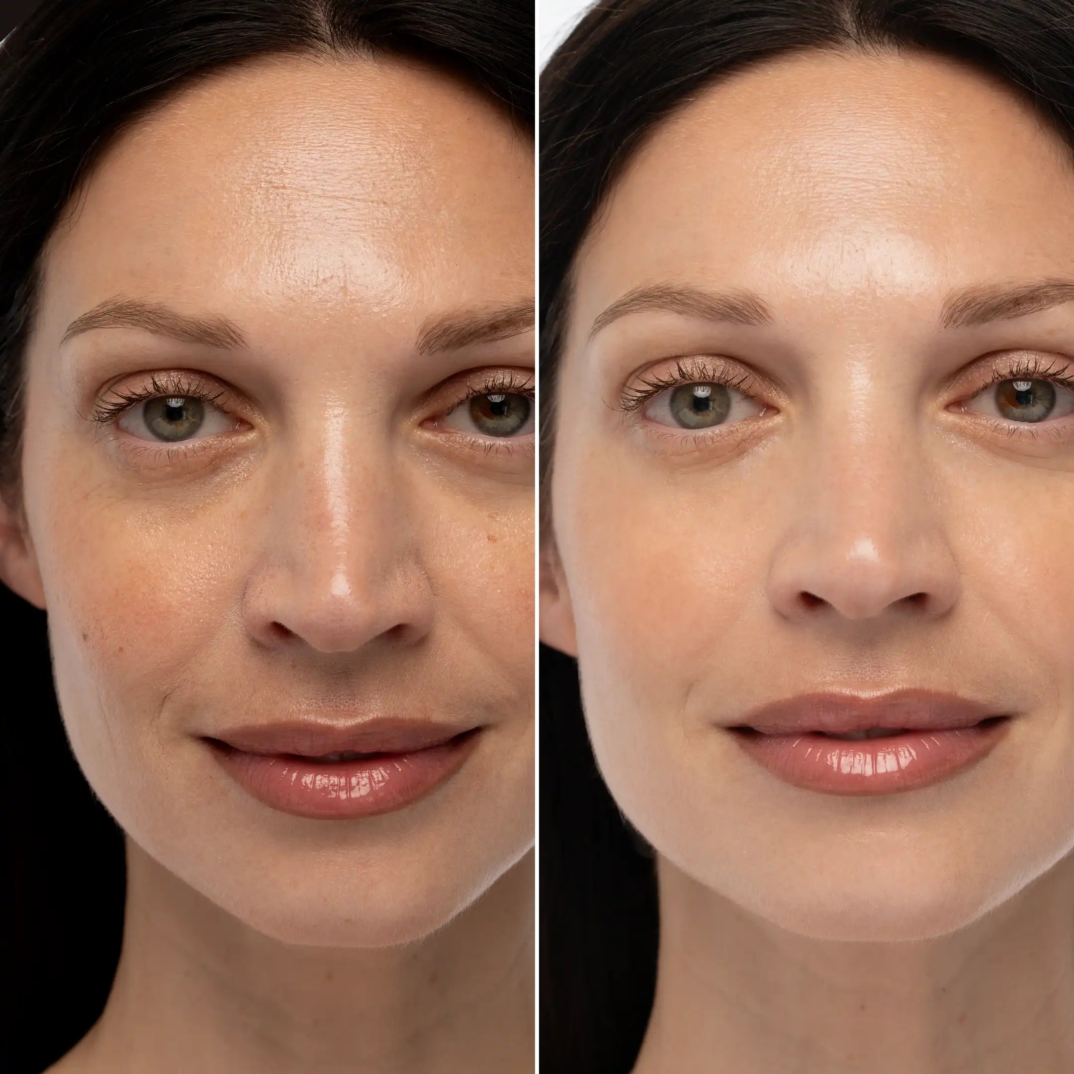 Glycolic Acid Exfoliating Pads