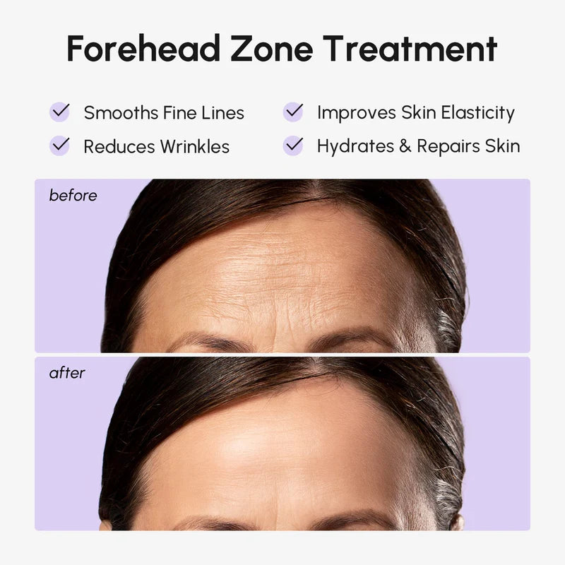 MARÉE Anti-Wrinkle Forehead Patches