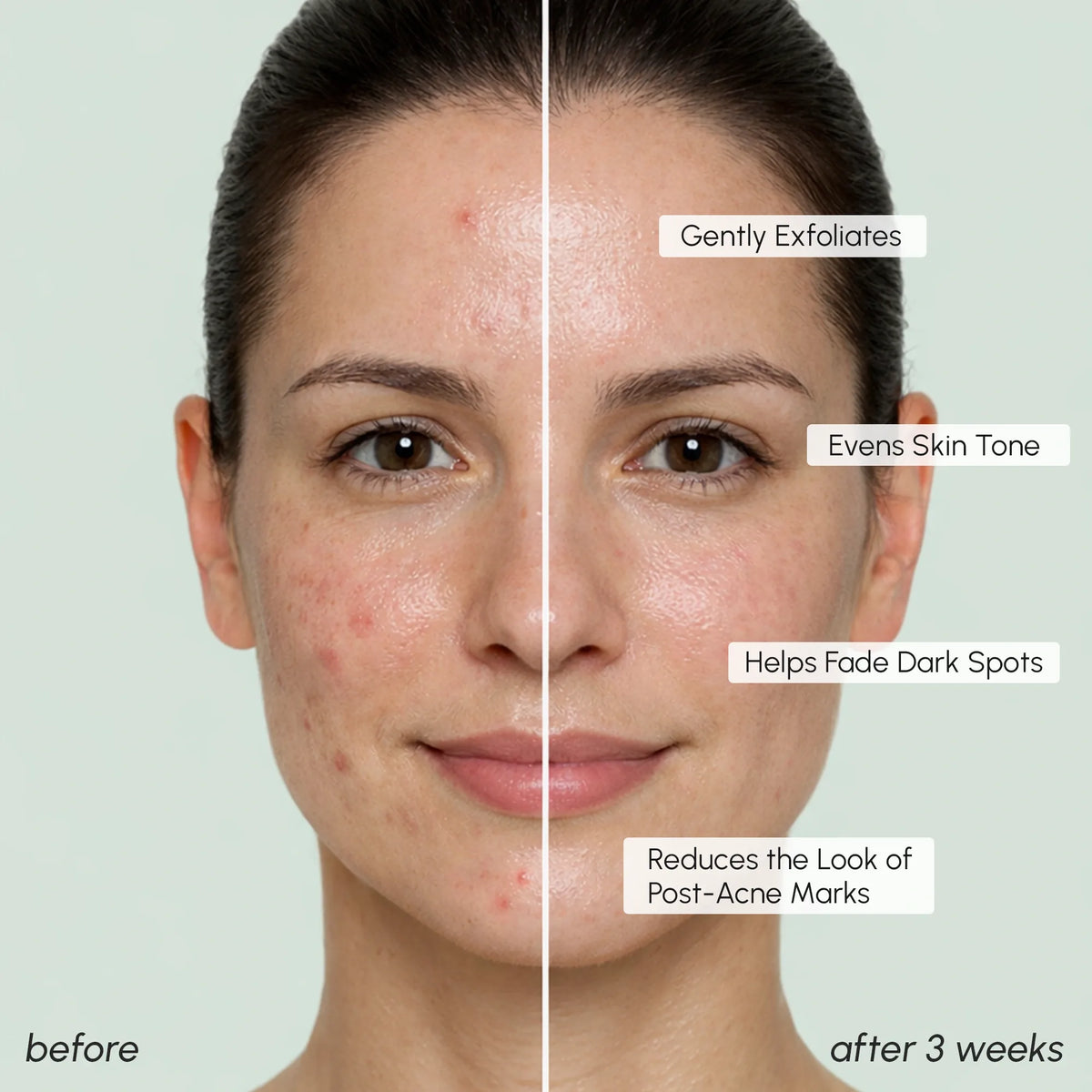 Glycolic Pads for Dark Spots and Hyperpigmentation