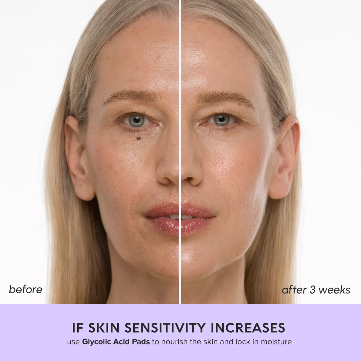 Glycolic Acid Pads for Menopausal Skin