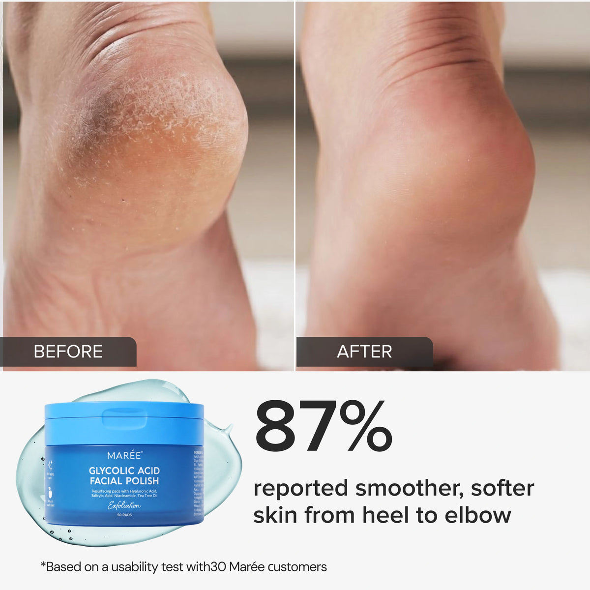 Glycolic Acid Exfoliating Pads for Body & Face