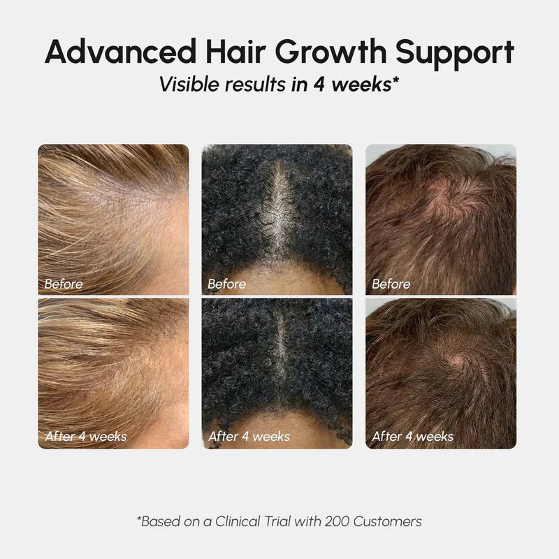 MARÉE 4-in-1 Hair Growth Spray