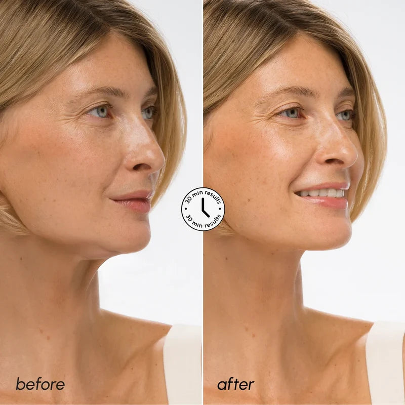 MARÉE Hyaluronic Acid V-line Lifting Mask