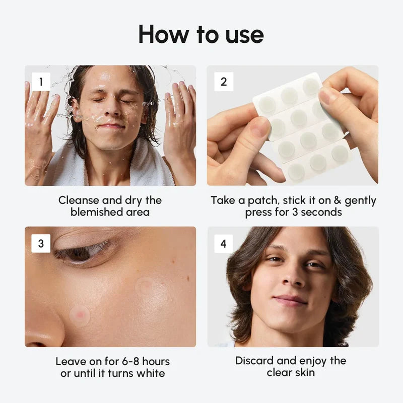 MARÉE Invisible Pimple & Acne Patches