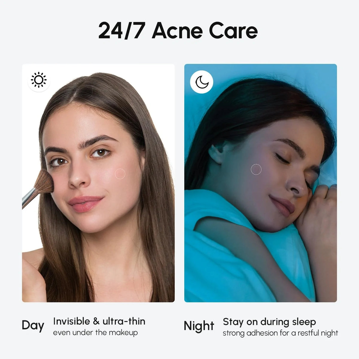 Invisible Pimple & Acne Patches