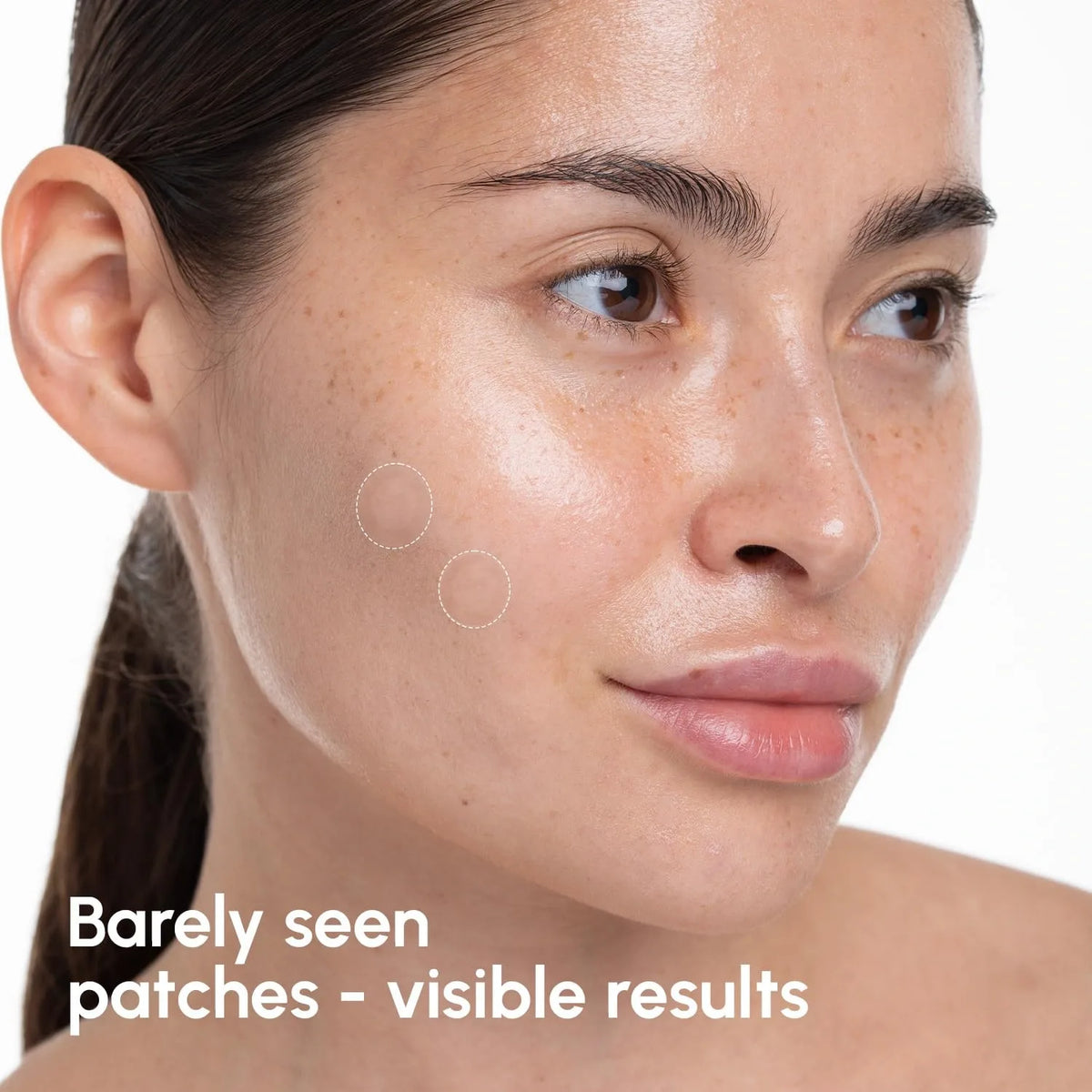 Invisible Pimple & Acne Patches