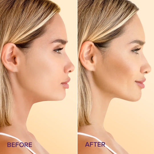 24K Gold V-Line Lifting Mask