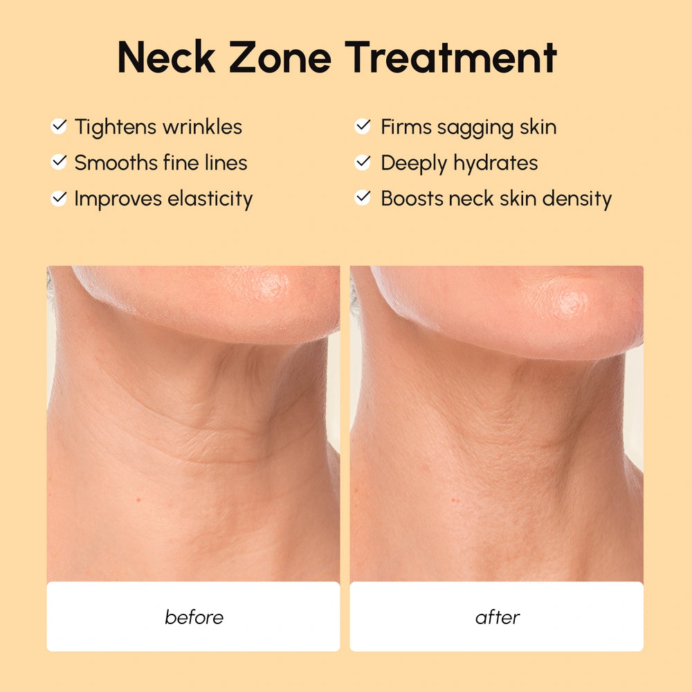 Lifting Neck Wrinkle Patches