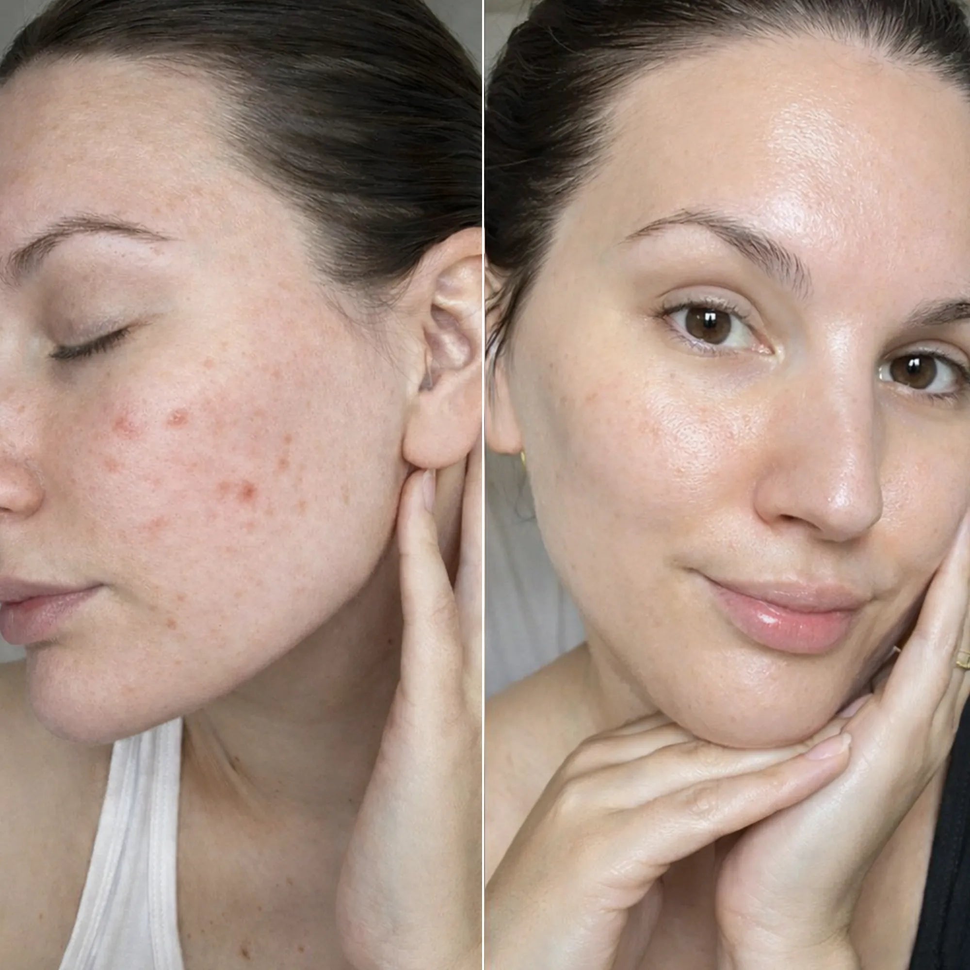 Vitamin C Radiance Pads