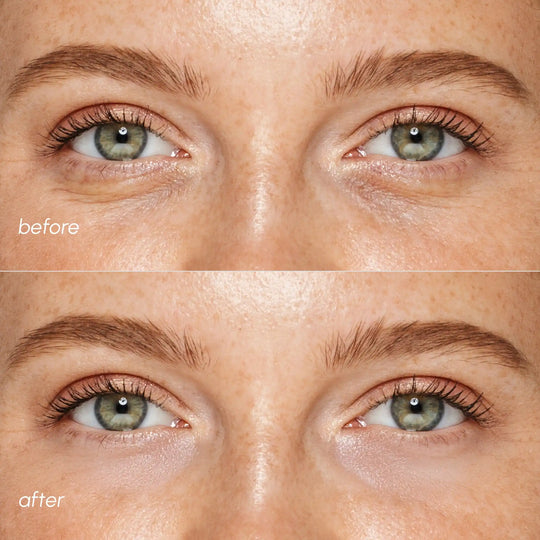 Pink Eye Patches for Puffy Eyes