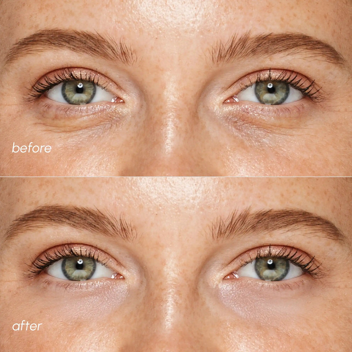 Pink Eye Patches for Puffy Eyes