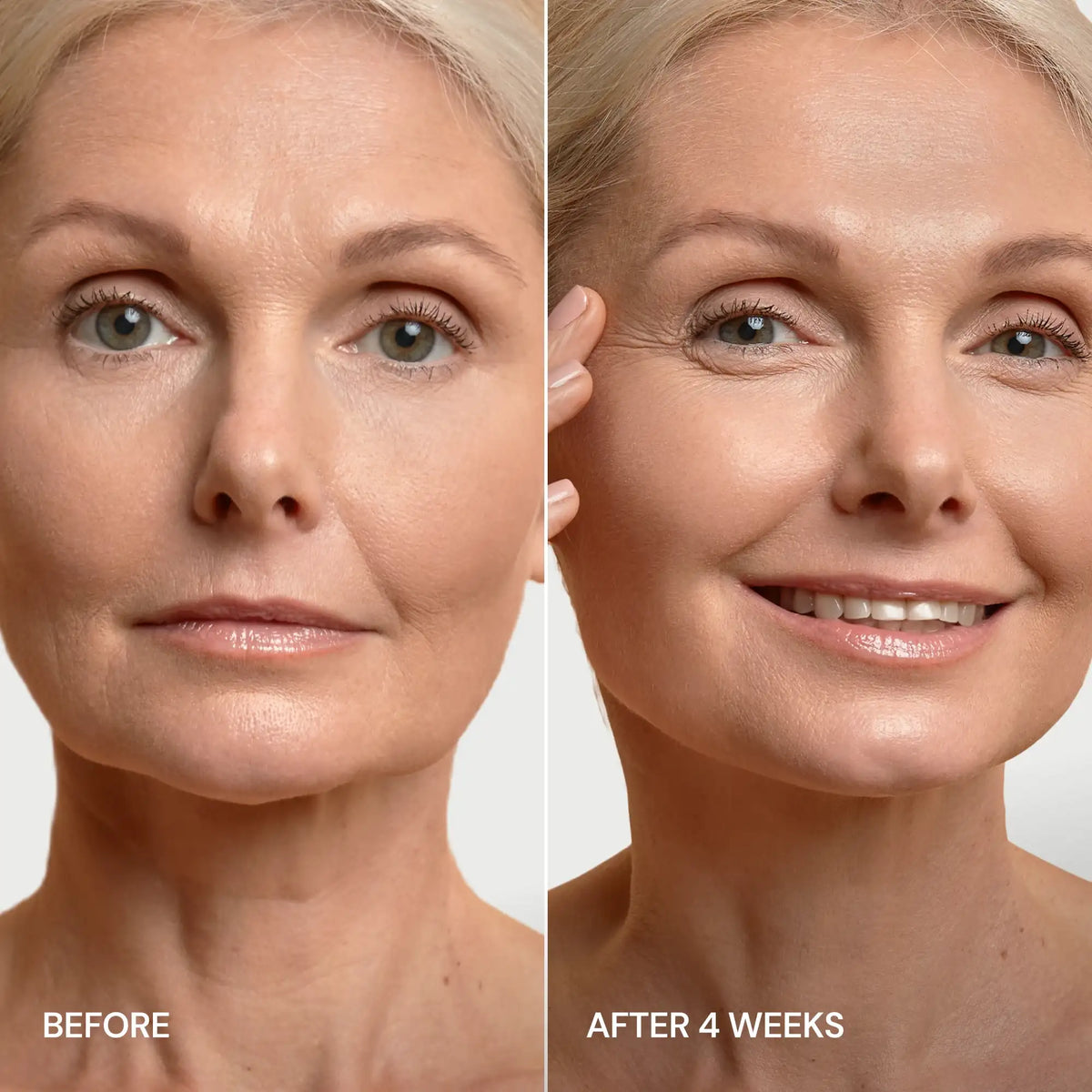 MARÉE 24K Gold V-Line Lifting Mask