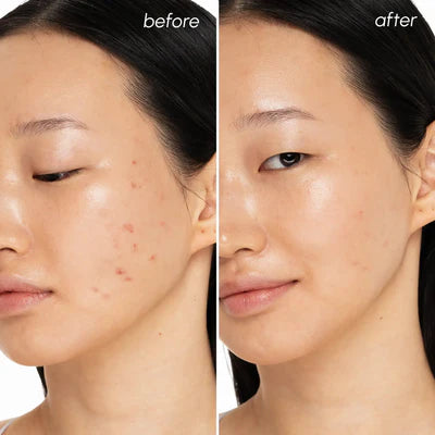 MARÉE Blemish Toner Pads