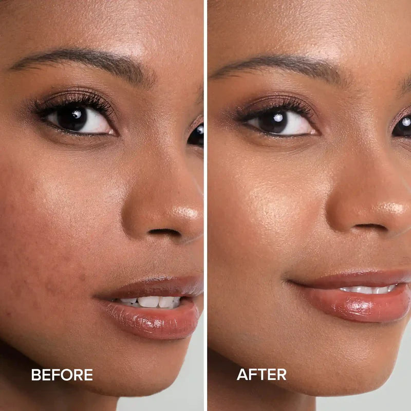 MARÉE Turmeric Kojic Soap & Scrub