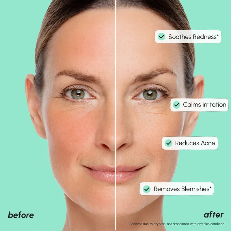 MARÉE Redness Soothing Azelaic Acid Serum