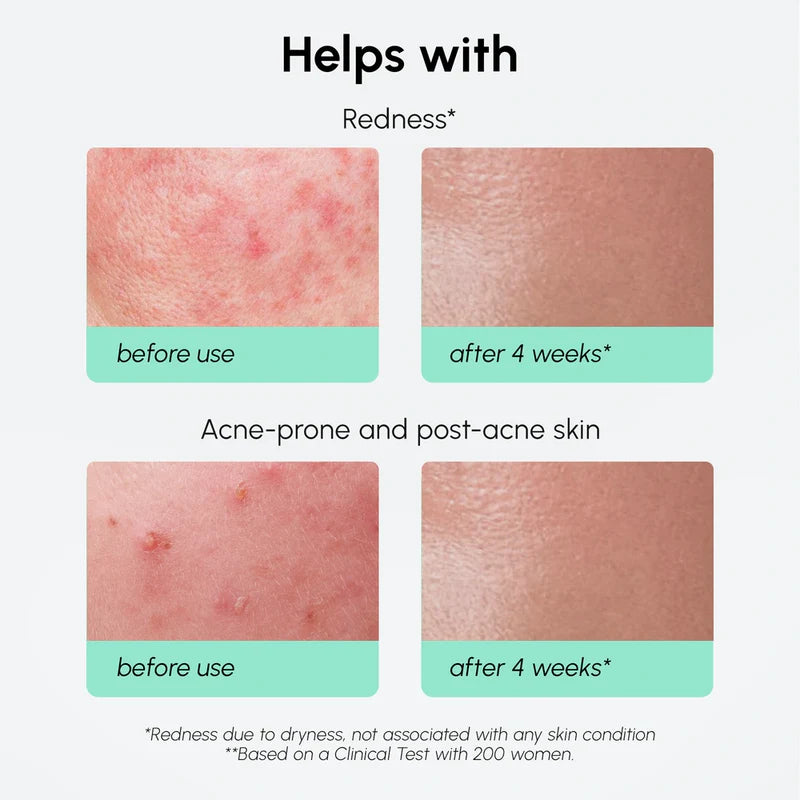 MARÉE Redness Soothing Azelaic Acid Serum