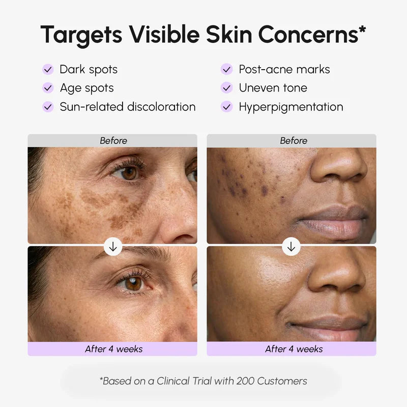 MARÉE Face & Body Serum for Dark Spots