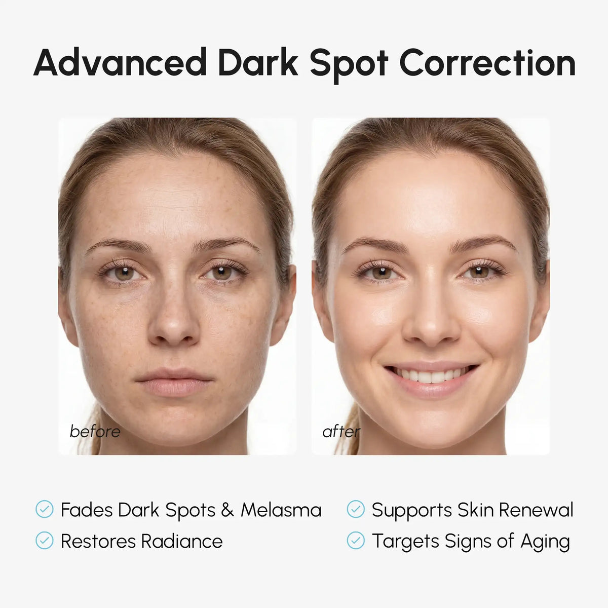 10% TXA Dark Spot Corrector Cream