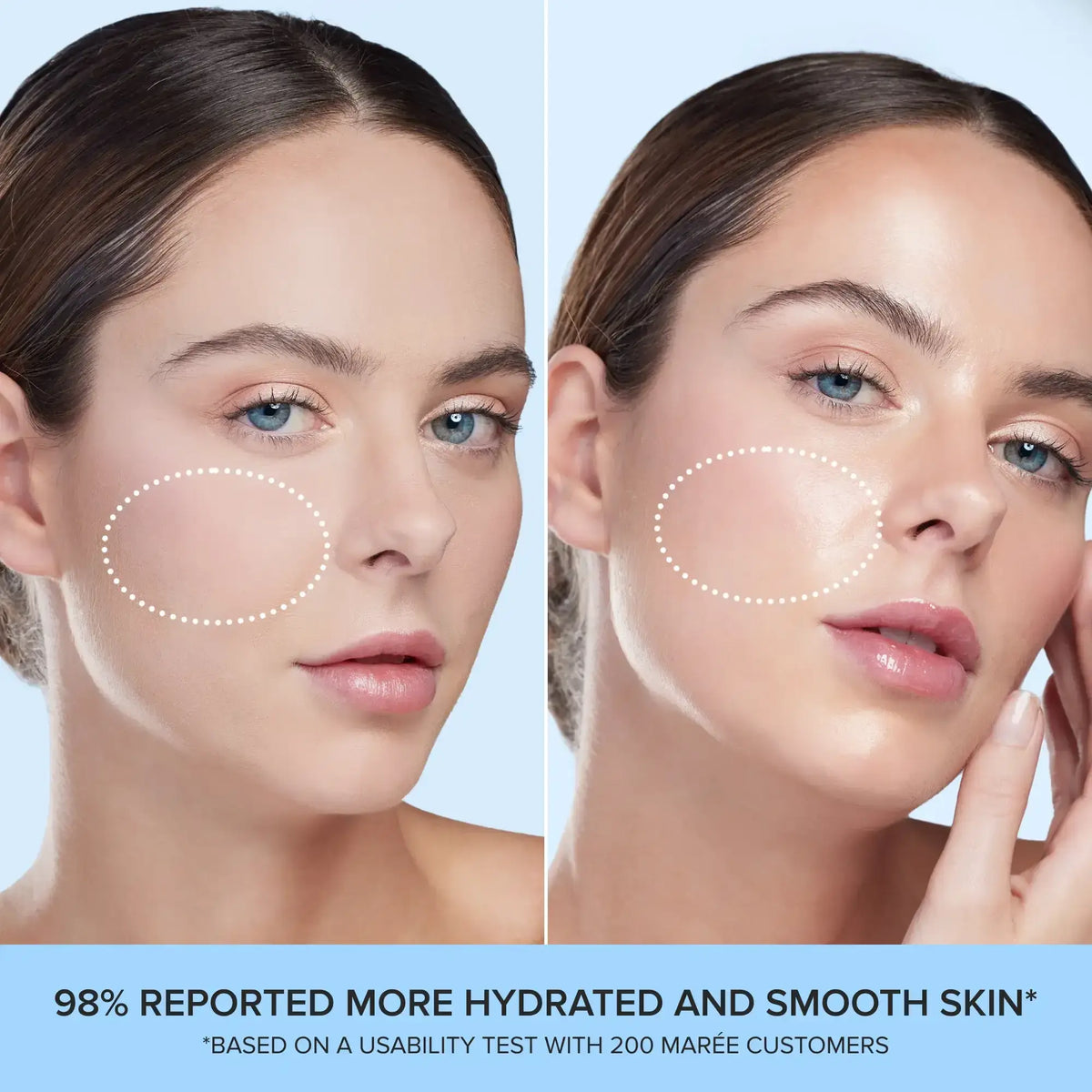 Dry Skin Essentials Kit