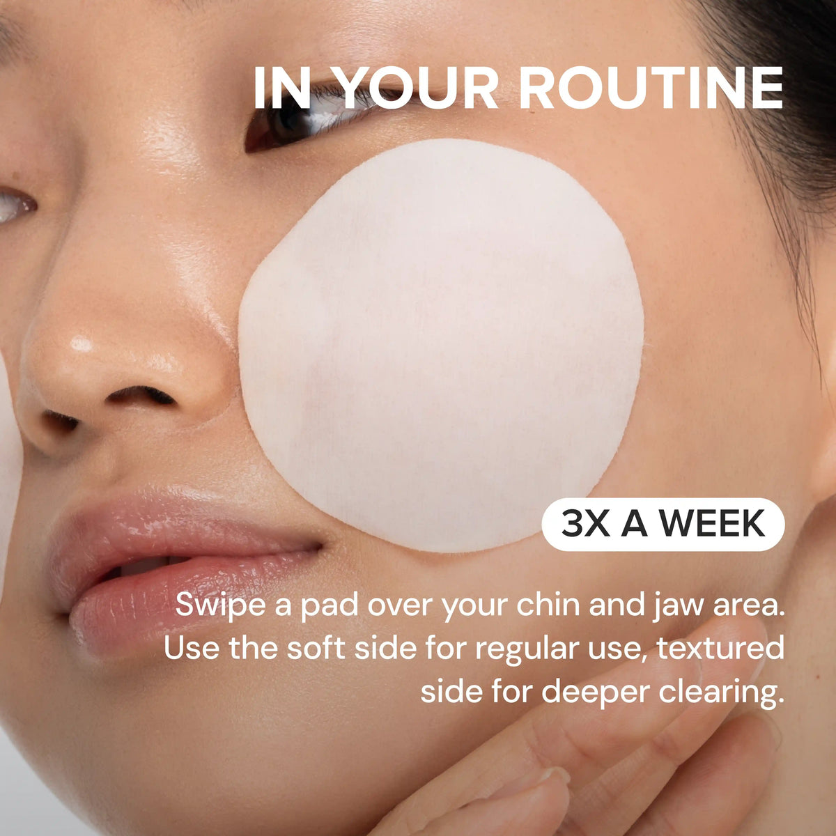Glycolic Pads for Chin Bumps & Breakouts