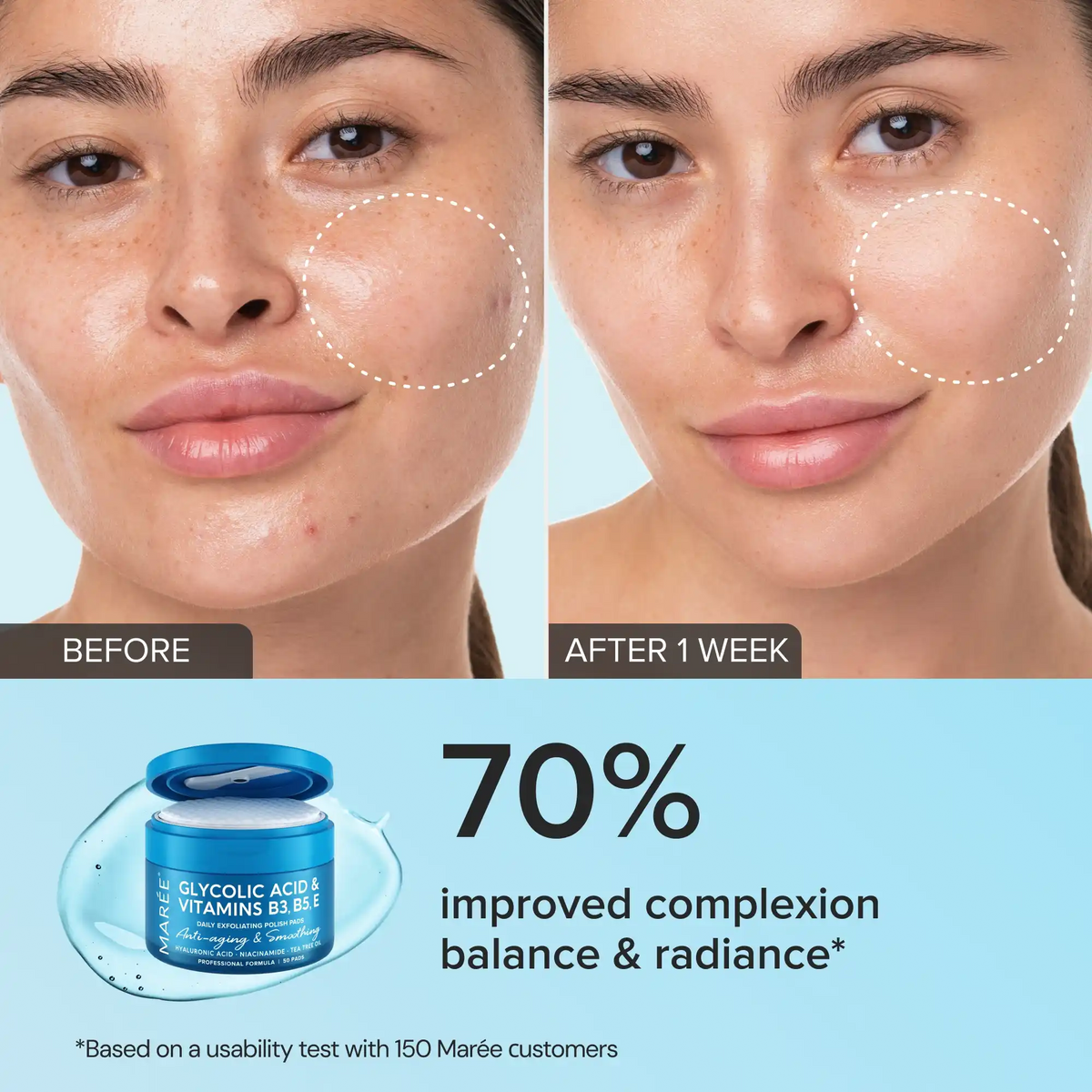 Glycolic Polish Acid Pads