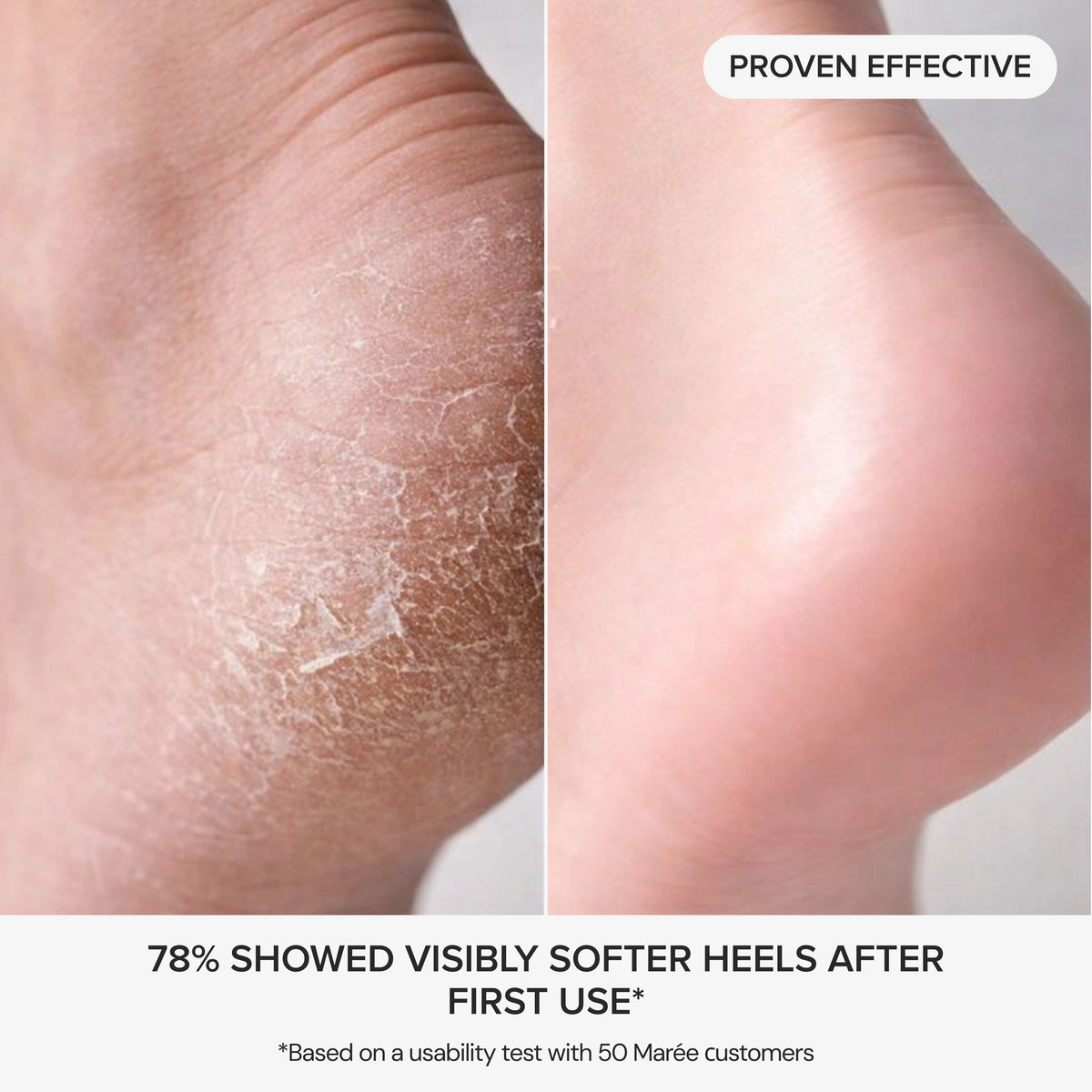 Glycolic Acid Exfoliating Pads for Body & Face