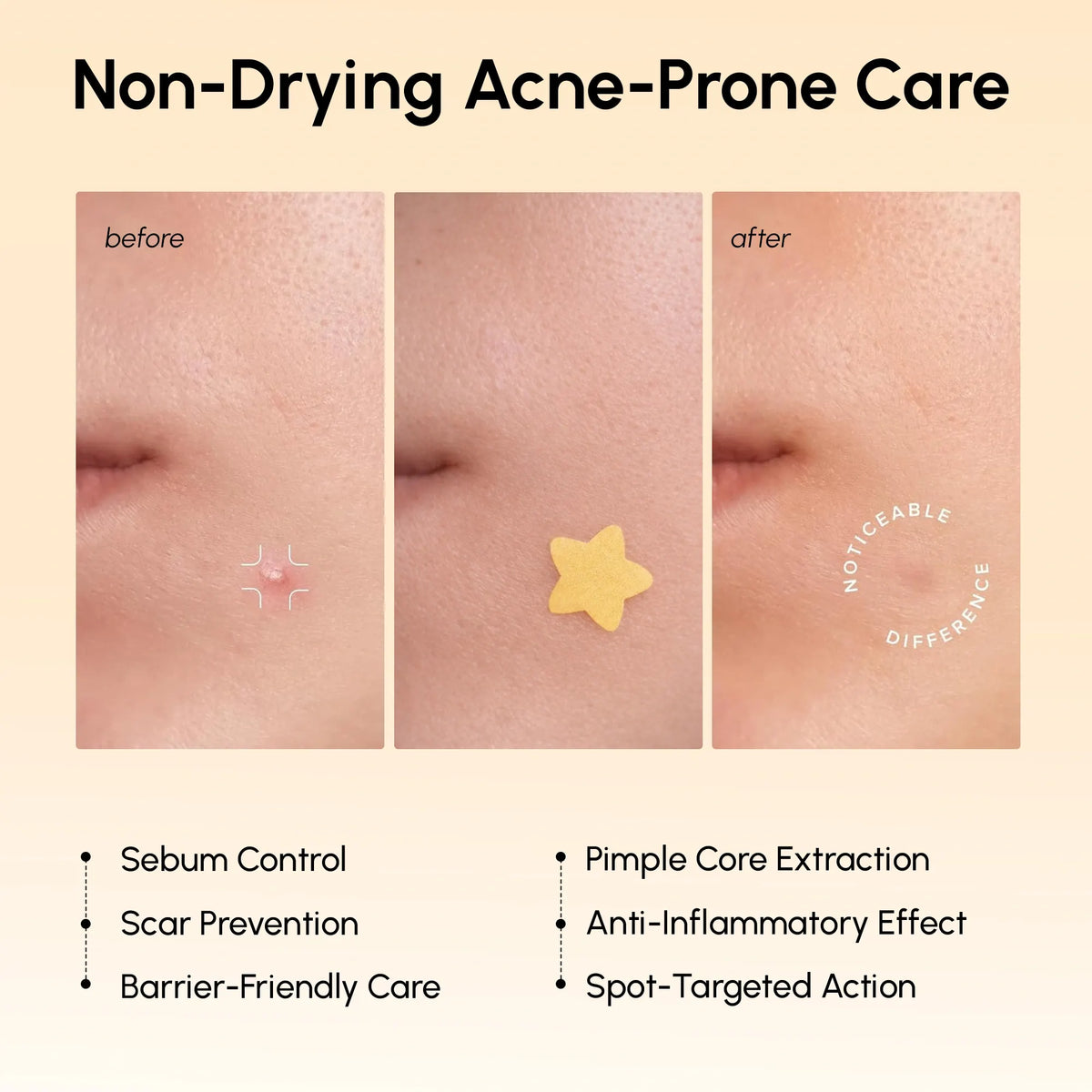 Gold Star Pimple & Acne Patches