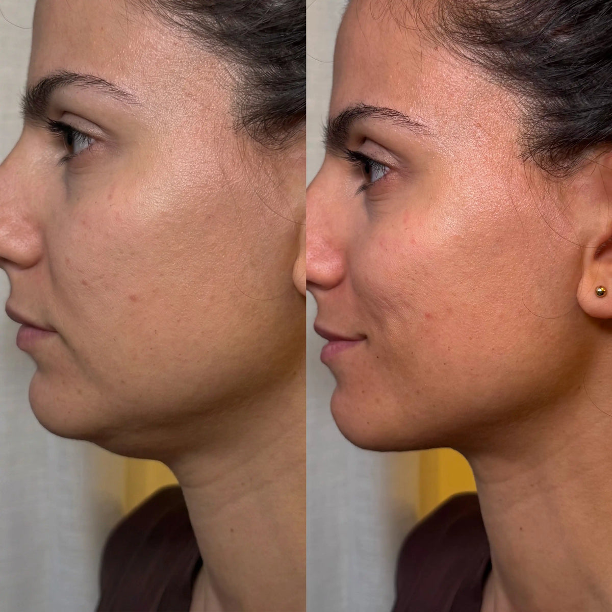 24K Gold Chin & Jawline Lifting Mask 20 PCS