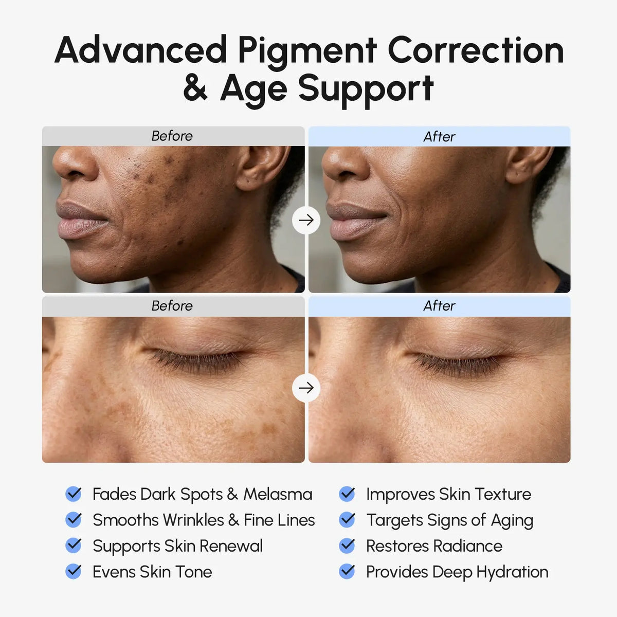 TXA+ Anti-aging Microspicules Cream