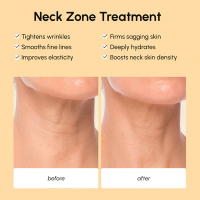MARÉE Lifting Neck Wrinkle Patches