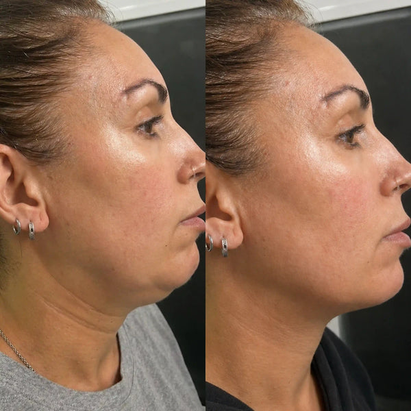 Customer result