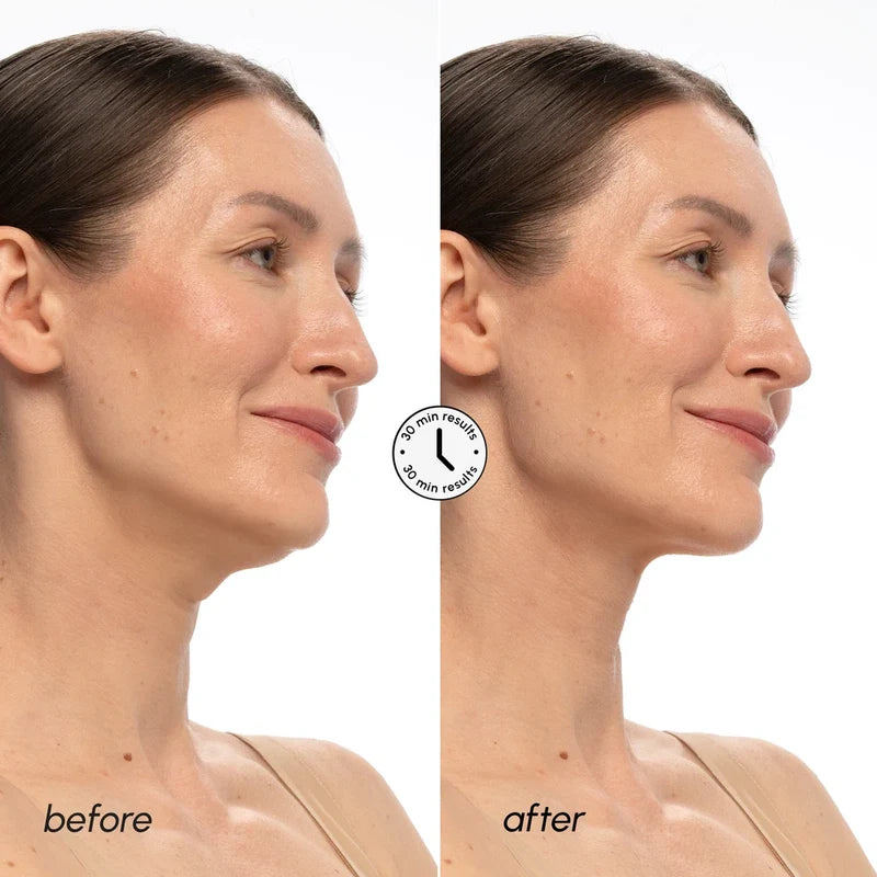 MARÉE PDRN V-line Lifting Mask