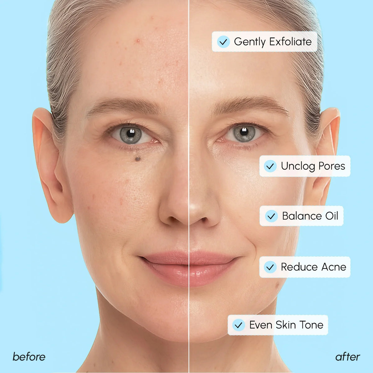 Glycolic & Salicylic Acid Peel Pads