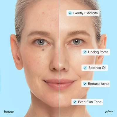 MARÉE Glycolic Acid Pads & 2% Salicylic Acid