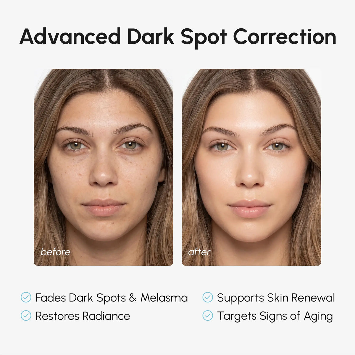 10% TXA & Alpha Arbutin Cream