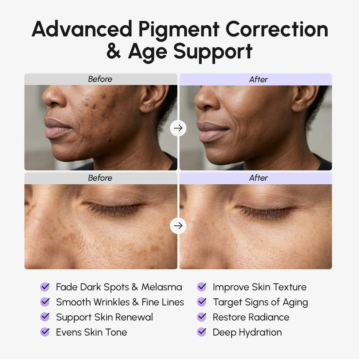 10% Tranexamic Serum Cream