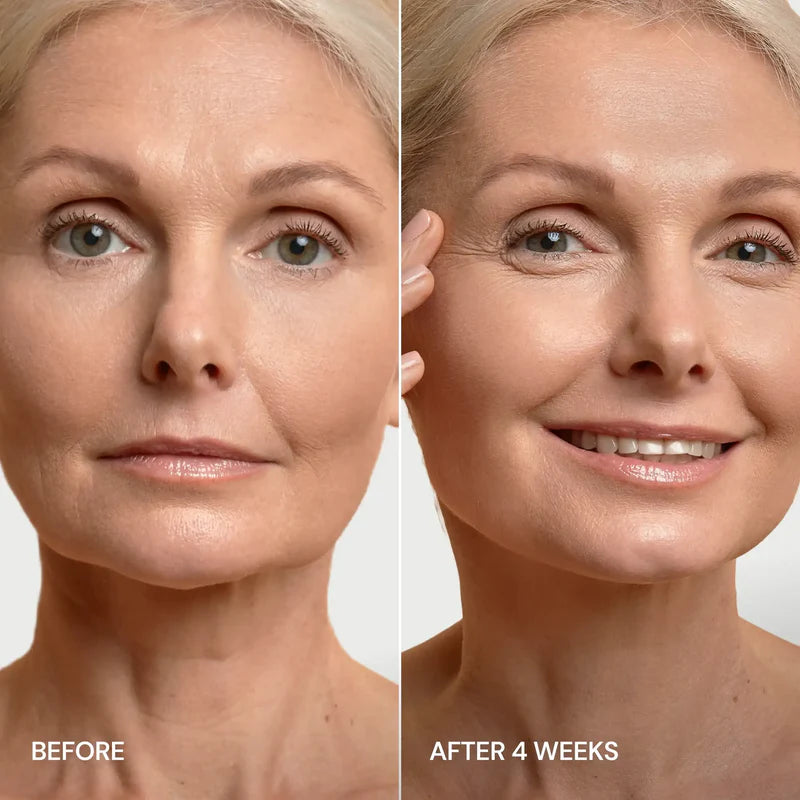 MARÉE 24K Gold V-Line Lifting Mask