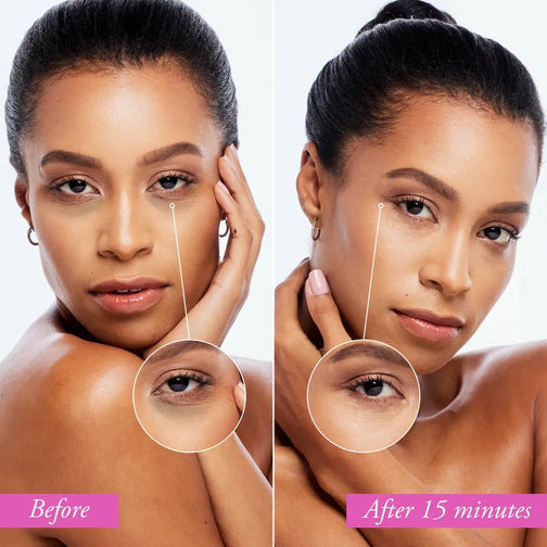 EYE GELS WITH NATURAL COLLAGEN THAT QUICKLY REMOVE PUFFY EYES AND DARK CIRCLES - Marée